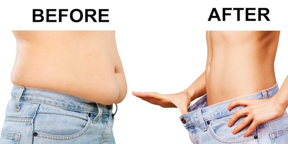 Liposuction: What Is It All About?